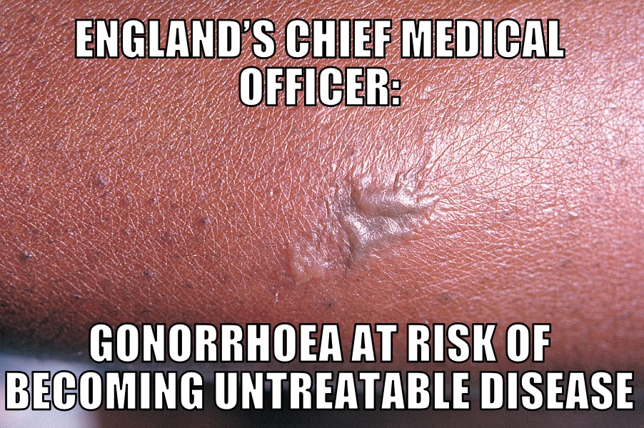 Untreatable Gonorrhoea