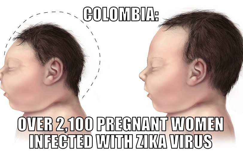 Colombian women infected with Zika virus