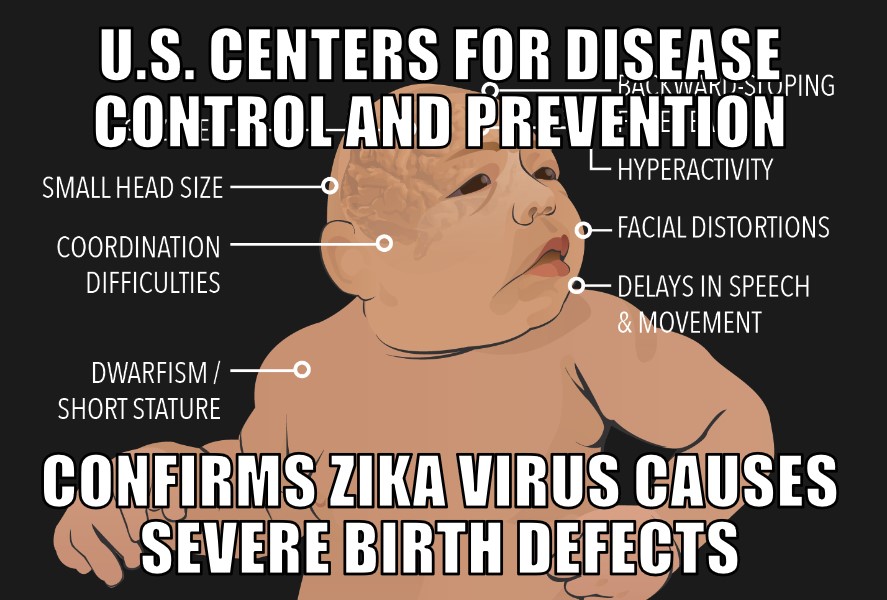Zika Causes Birth Defects