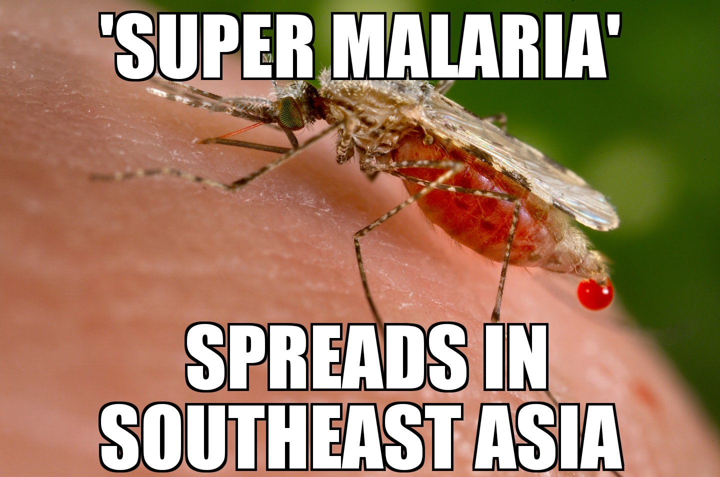 ‘Super malaria’ spreads