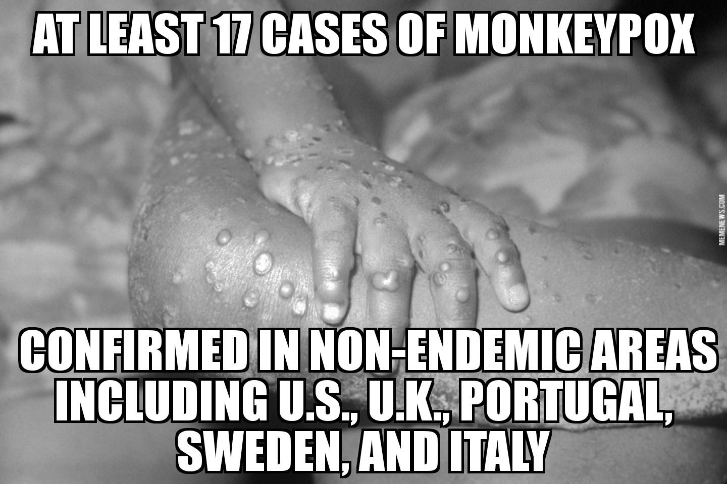 Monkeypox cases spread