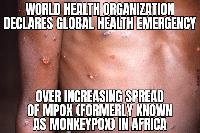 WHO declares health emergency over Mpox spread
